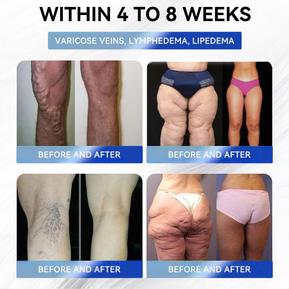 CVS Online Store | Myo Clinic Longevity GLP-1 8-in-1 Slim & Healthy Oral Solution(Once a day, visible results in 7 days) Supports obesity, cardiovascular health, diabetes, sleep apnea, gut health, joint issues, while also firming the skin
