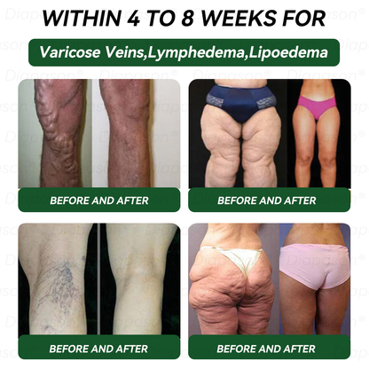 Official Store | Myo Clinic GLP-1 9-IN-1 Slim & Healthy Oral Solution(Once a day, visible results in 7 days) Supports obesity, cardiovascular health, diabetes, sleep apnea, gut health, joint issues, while also firming the skin and boosting energy