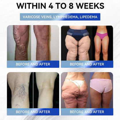 CVS Online Store | Myo Clinic Longevity GLP-1 8-in-1 Slim & Healthy Oral Solution(Once a day, visible results in 7 days) Supports obesity, cardiovascular health, diabetes, sleep apnea, gut health, joint issues, while also firming the skin